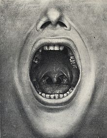 Illustration of a mouth with teeth removed from Cotton's book The defective delinquent and insane: the relation of focal infections to their causation, treatment and prevention.